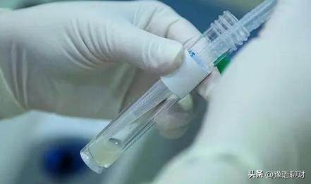 正规精子库_中国不孕不育调研报告_地下捐精市场