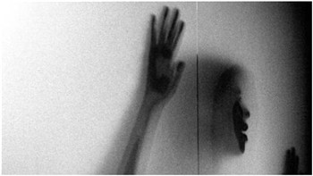 社交恐惧症表现有哪些？