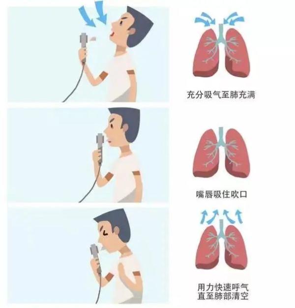 名医专栏丨慢阻肺的防与治